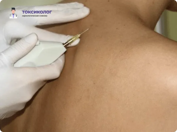 Проведение медицинской процедуры в клинике — системная комплексная блокада в область спины.